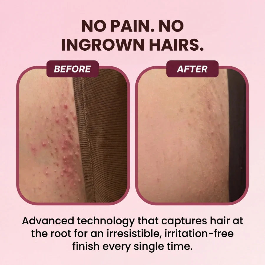 UVIVES™ | On The Go Lady Shaver